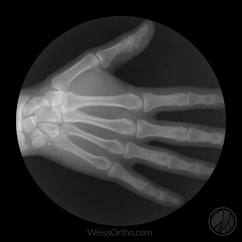 Hand of the X-RAY
